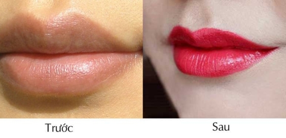Phun xăm thẩm mỹ môi trước và sau tại Nhân Nguyễn